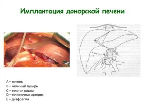 Где в москве можно стать донором печени