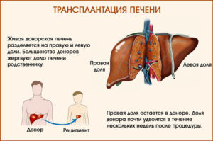 Где в москве можно стать донором печени